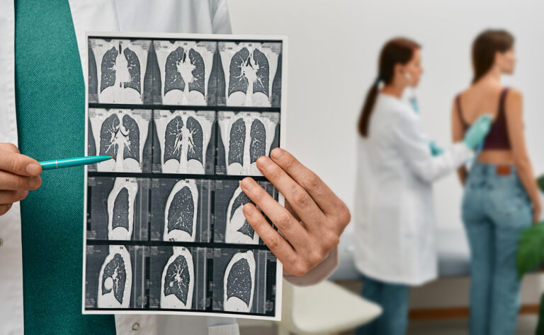Pulmonologist showing CT scan of lungs female with pneumonia over background lungs exam for patient. Lung disease, pulmonary fibrosis