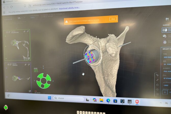 Mudr. mesiarik pri operacii 3.jpeg