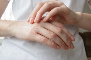 suchá pokožka na rukách