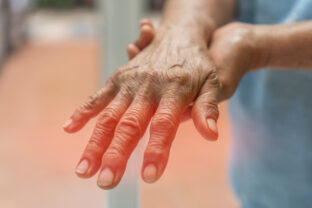 Príznaky cukrovky: Týchto 14 zmien na tele Slováci často ignorujú