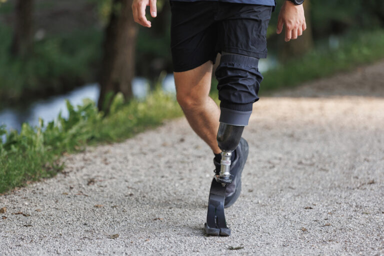 Man with a versatile prosthetic leg walking along the greenway during recreation