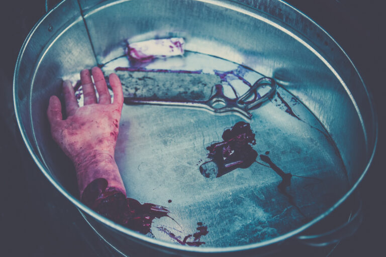 Hand amputated by a medical saw, as an illustration of the work of doctors during the war or illegal activities of surgeons or crime scene. Toned image
