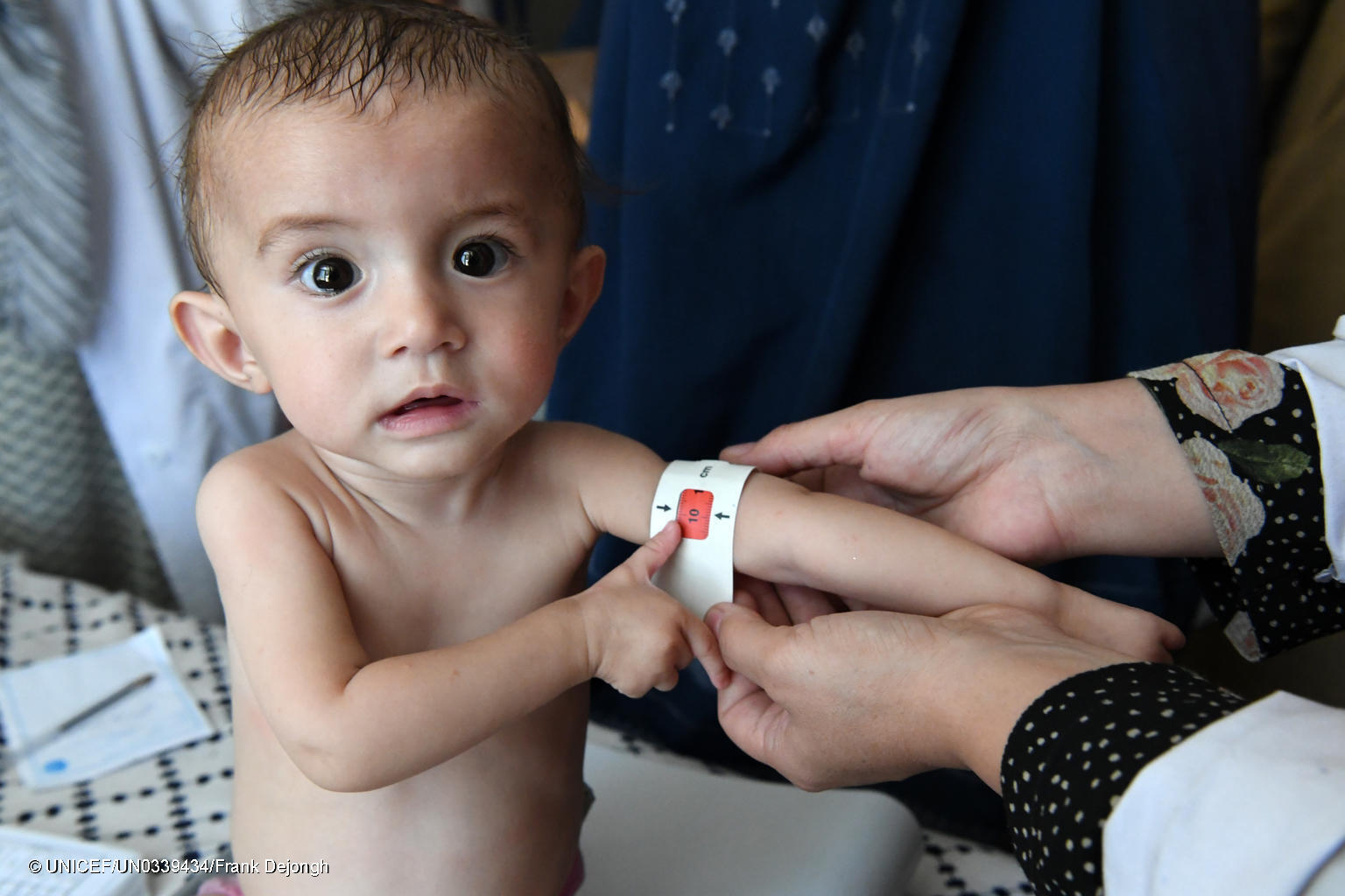 AFG.NUTRITION.Kishem.22.08.2019.UNICEF.FrankDejongh.4425