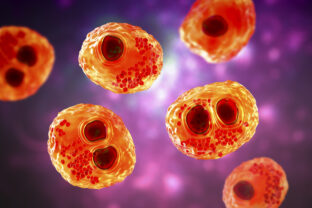 Cytomegalovirus infection, illustration