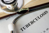 Tuberkuloza diagnoza lieba vysetrenie diagnostika