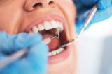 Zubar zubná prehliadka dentalna hygiena