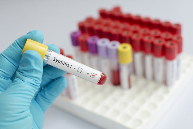 Syphilis syfilis nárast nakaz vysetrenie