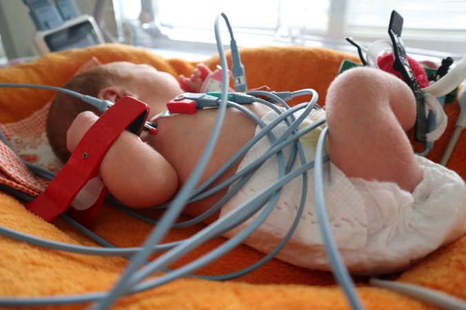 Fnsp za_zdravotnici mozu realizovat vysetrenie srdca novorodencov priamo v inkubatore.jpg