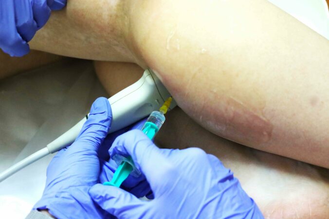 Fnsp za_odbornici aplikuju botulotoxin na neurologickej ambulancii.jpg