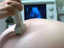 Sonografické vyšetrenie počas tehotenstva