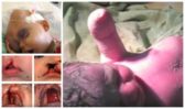 Fajčenie v tehotenstve: Viete, čo sa deje s Vašim bábätkom? V tomto článku o dôsledkoch a rizikách "bez servítky"