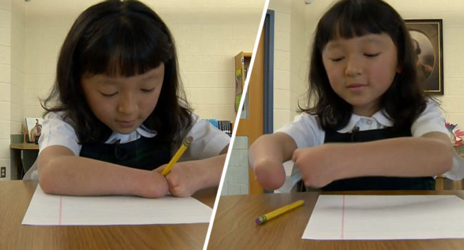 Dievčatko (10), ktoré sa narodilo bez rúk, zabodovalo na súťaži v písaní