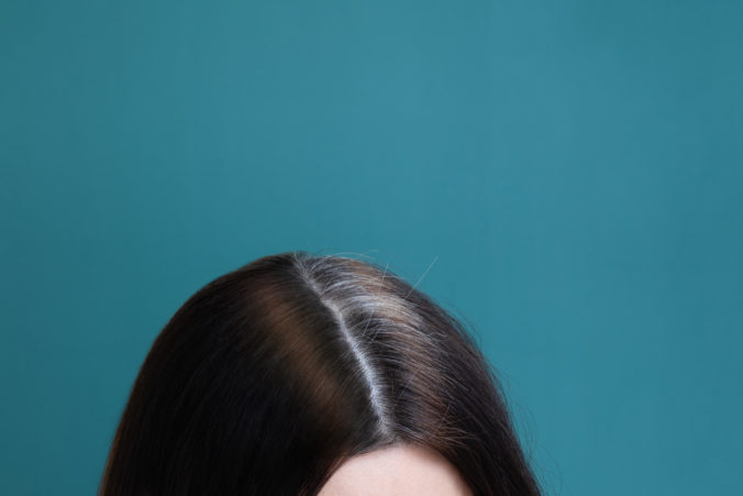 Vedci zistili, ako je šedivenie vlasov spojené so stresom