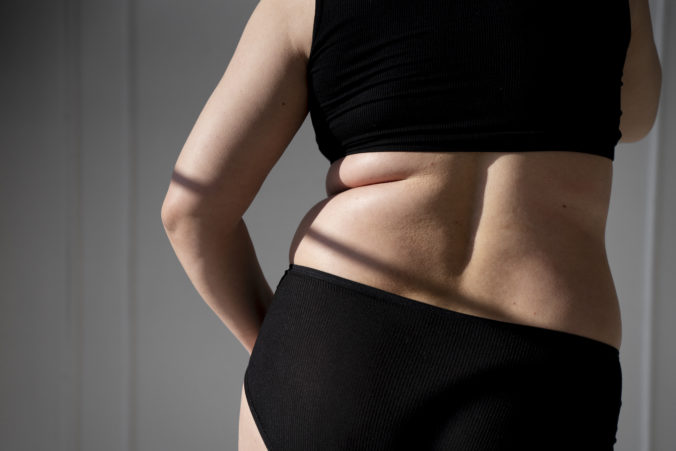 Ako sa zbaviť tukových záhybov na chrbte – tipy na letnú sezónu