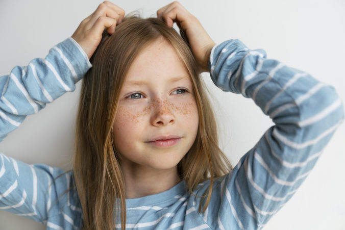 Ako zastaviť vypadávanie vlasov u detí: Príčiny a riešenia