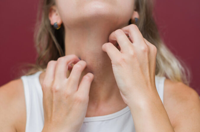 Morgellons: Záhadné ochorenie