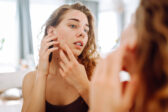 Hormonálne akné: Prečo vzniká a ako sa ho zbaviť raz a navždy