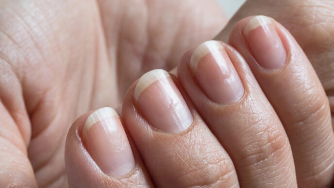 Ako odhaliť problémy s nechtami: niektoré signály sa neoplatí ignorovať
