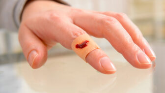 Vianoce a domáce úrazy: ako si poradiť s popáleninami, porezaniami aj zraneniami očí