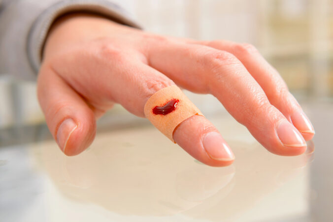 Vianoce a domáce úrazy: ako si poradiť s popáleninami, porezaniami aj zraneniami očí