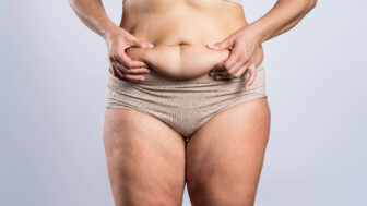 Prečo v menopauze pribúda brucho, opúchajú nohy a telo zadržiava vodu