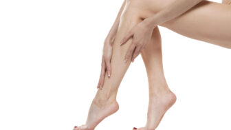 Kŕčové žily: Ako ich zvládnuť a predchádzať im pomocou žilnej gymnastiky